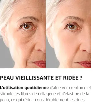 aloe vera rafermissement de la peau